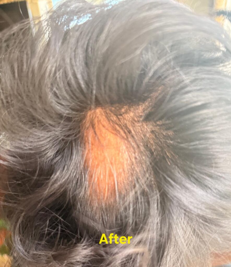 Image #1 from Nabeesh